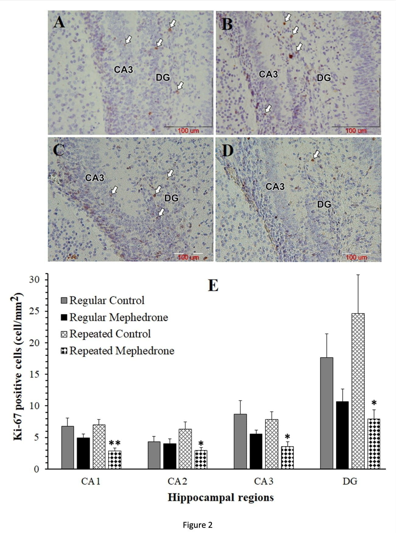<strong>Neurotoxic effects of mephedrone in an embryo cause stillbirth or hippocampal death</strong>