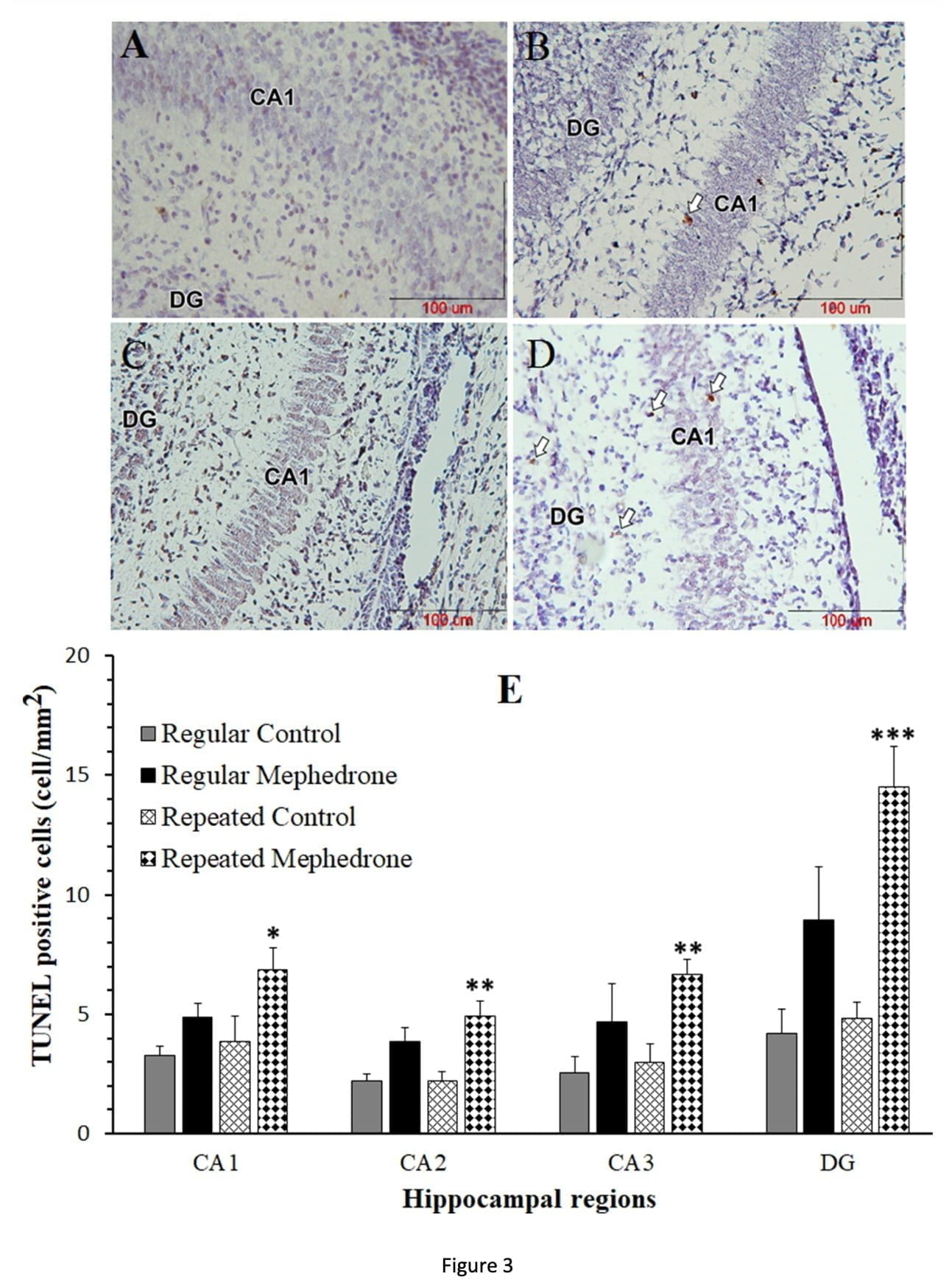 <strong>Neurotoxic effects of mephedrone in an embryo cause stillbirth or hippocampal death</strong>